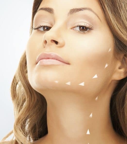 hifu face uplift min