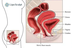 Treatment For A Leaky Bladder 2 How EM Chair treatment Norwich can help Leaky bladder issues. Read more now!